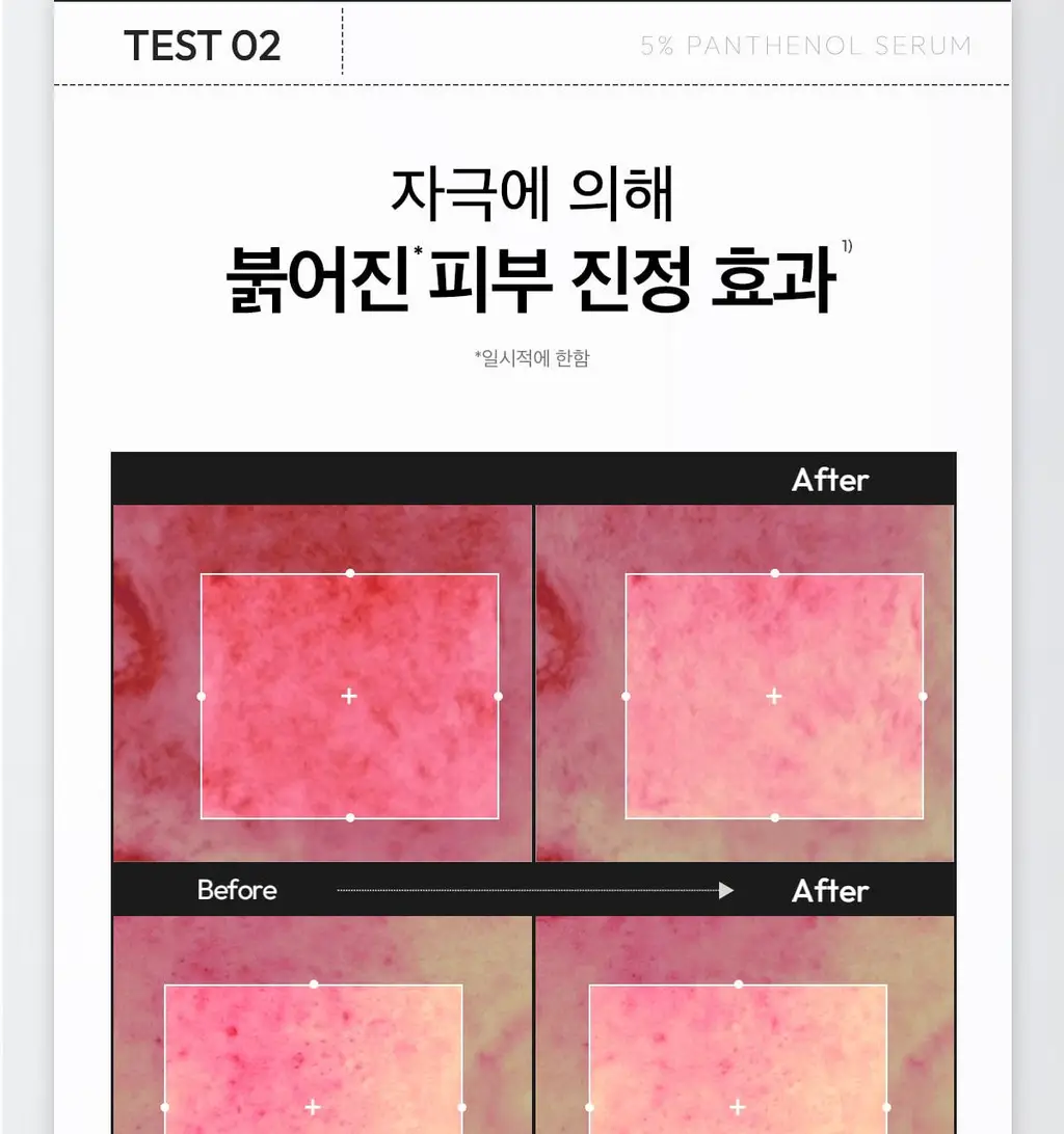 [1+1/속보습 진정세럼] 레이어랩 니오좀 판테놀 5% 세럼 30ml+30ml 더블 기획 상세페이지 19